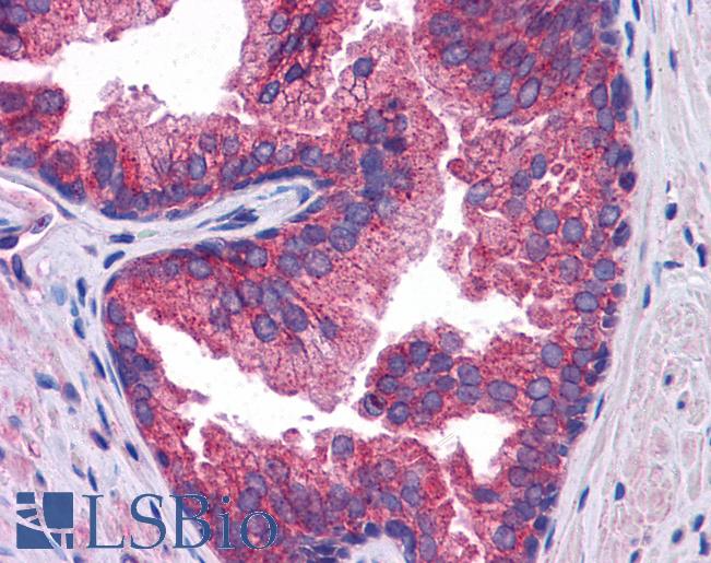 Anti-SLC39A10 antibody IHC of human prostate. Immunohistochemistry of formalin-fixed, paraffin-embedded tissue after heat-induced antigen retrieval. Antibody LS-B5357 concentration 5 ug/ml.
