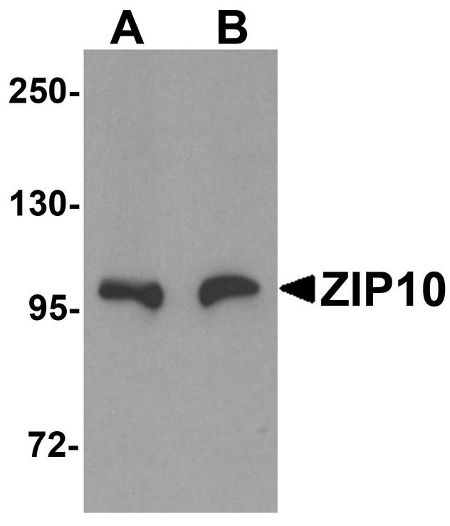 Western blot analysis of ZIP10 in human spleen tissue lysate with ZIP10 antibody at (A) 1 and (B) 2 ug/ml.