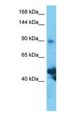Western blot of SLC39A10 Antibody with human Thymus Tumor lysate.