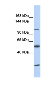 SLC39A10 antibody LS-C110845 Western blot of Fetal Heart lysate.