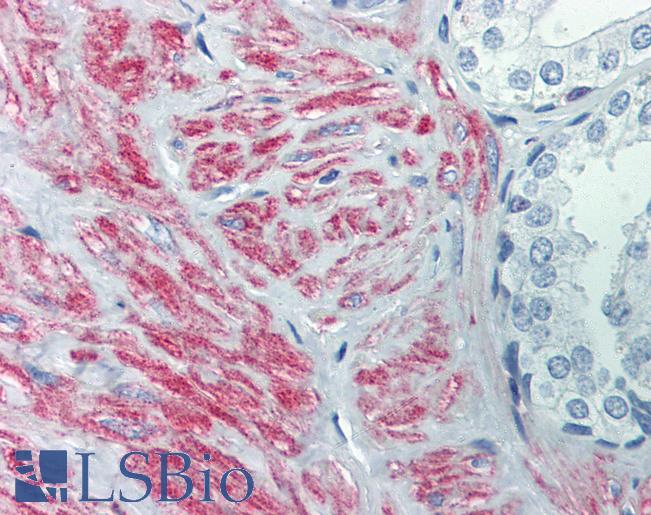 Anti-SLC39A10 antibody IHC of human prostate. Immunohistochemistry of formalin-fixed, paraffin-embedded tissue after heat-induced antigen retrieval. Antibody LS-B2837 concentration 5 ug/ml.