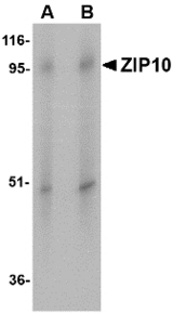 Western blot of ZIP10 in human spleen tissue lysate with ZIP10 antibody at (A) 1 and (B) 2 ug/ml.