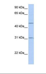 721_B cell lysate. Antibody concentration: 1.0 ug/ml. Gel concentration: 12%.