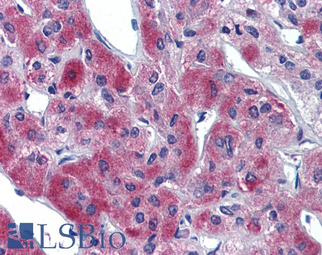 Anti-SLC39A11 antibody IHC of human adrenal. Immunohistochemistry of formalin-fixed, paraffin-embedded tissue after heat-induced antigen retrieval. Antibody LS-B3871 concentration 5 ug/ml.