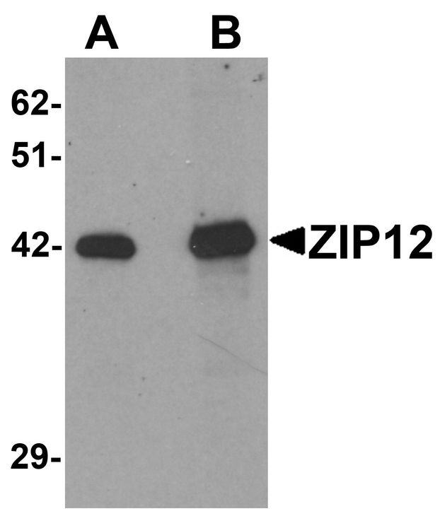 Western blot analysis of ZIP12 in HepG2 cell lysate with ZIP12 antibody at (A) 0.5 and (B) 1 ug/ml.