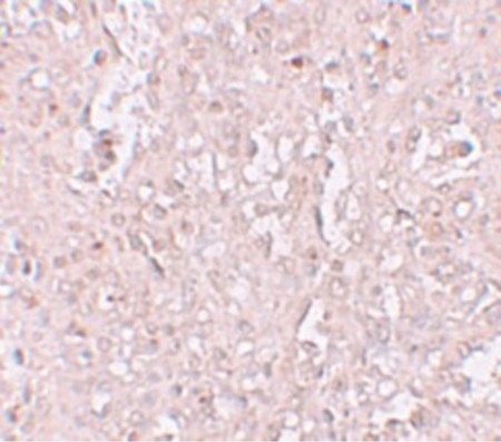 Immunohistochemistry of ZIP13 in human spleen tissue with ZIP13 antibody at 2.5 ug/ml.