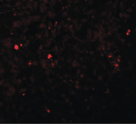 Immunofluorescence of ZIP13 in human spleen tissue with ZIP13 antibody at 20 ug/ml.
