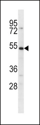 SLC39A14 Antibody western blot of U251 cell line lysates (35 ug/lane). The SLC39A14 antibody detected the SLC39A14 protein (arrow).