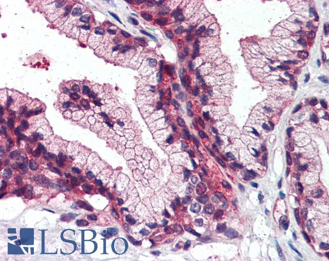 Anti-SLC39A14 antibody LS-A8201 IHC of human prostate. Immunohistochemistry of formalin-fixed, paraffin-embedded tissue after heat-induced antigen retrieval.