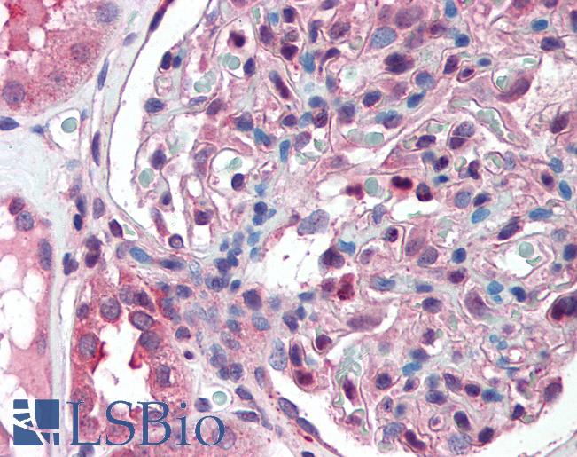 Anti-SLC39A14 antibody LS-A8201 IHC of human kidney. Immunohistochemistry of formalin-fixed, paraffin-embedded tissue after heat-induced antigen retrieval.