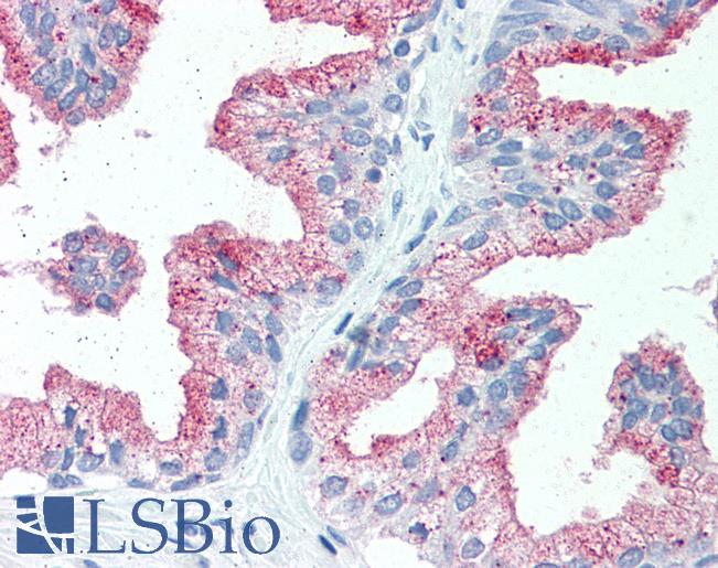 Anti-SLC39A14 antibody LS-A8199 IHC of human prostate. Immunohistochemistry of formalin-fixed, paraffin-embedded tissue after heat-induced antigen retrieval.