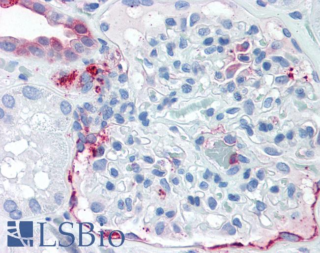 Anti-SLC39A14 antibody LS-A8199 IHC of human kidney. Immunohistochemistry of formalin-fixed, paraffin-embedded tissue after heat-induced antigen retrieval.