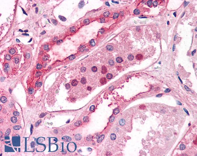 Anti-SLC39A14 antibody LS-A9851 IHC of human kidney. Immunohistochemistry of formalin-fixed, paraffin-embedded tissue after heat-induced antigen retrieval.