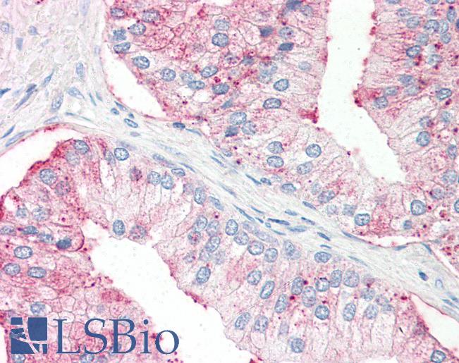 Anti-SLC39A14 antibody LS-A9851 IHC of human prostate. Immunohistochemistry of formalin-fixed, paraffin-embedded tissue after heat-induced antigen retrieval.