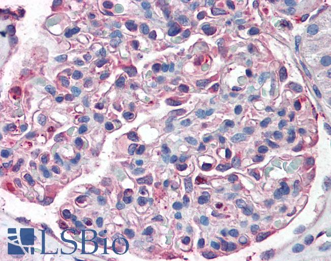 Anti-SLC39A14 antibody LS-A8196 IHC of human kidney. Immunohistochemistry of formalin-fixed, paraffin-embedded tissue after heat-induced antigen retrieval.