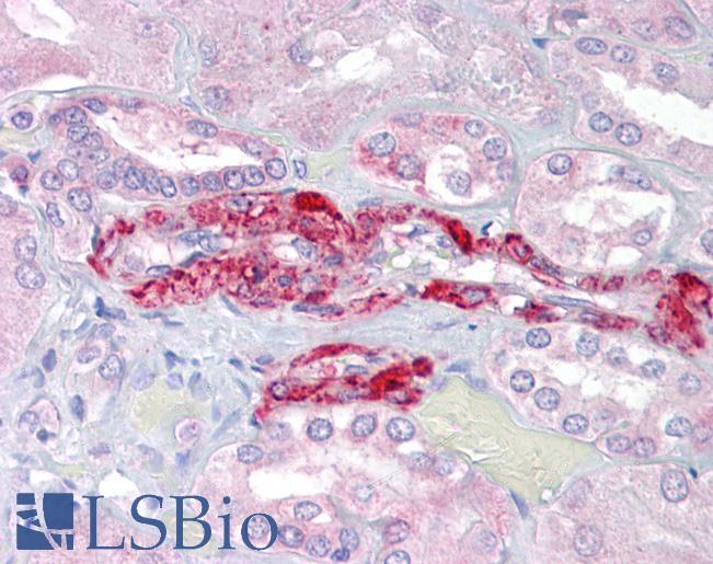 Anti-SLC39A14 antibody IHC of human kidney. Immunohistochemistry of formalin-fixed, paraffin-embedded tissue after heat-induced antigen retrieval. Antibody LS-B7008 concentration 5 ug/ml.