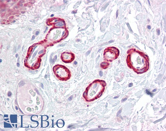 Anti-SLC39A14 antibody IHC of human colon, vessels. Immunohistochemistry of formalin-fixed, paraffin-embedded tissue after heat-induced antigen retrieval. Antibody LS-B7008 concentration 5 ug/ml.