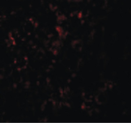 Immunofluorescence of ZIP14 in Mouse Liver cells with ZIP14 antibody at 20 ug/ml.