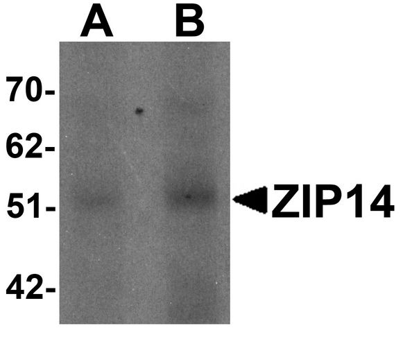 Western blot analysis of ZIP14 in human spleen tissue lysate with ZIP14 antibody at (A) 1 and (B) 2 ug/ml.