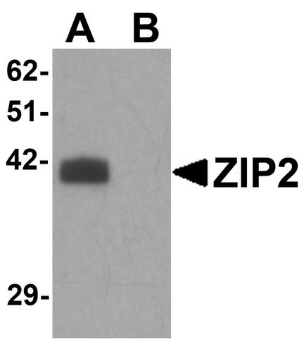 Western blot analysis of ZIP2 in rat brain tissue lysate with ZIP2 antibody at 1 ug/ml in (A) the absence and (B) the presence of blocking peptide.