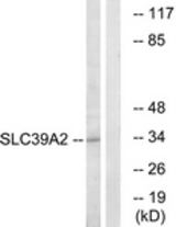 Western blot of extracts from Jurkat cells, using SLC39A2 Antibody. The lane on the right was incubated with synthetic peptide.