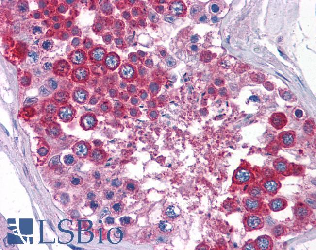 Anti-SLC39A3 antibody IHC of human testis. Immunohistochemistry of formalin-fixed, paraffin-embedded tissue after heat-induced antigen retrieval. Antibody LS-B5354 concentration 5 ug/ml.