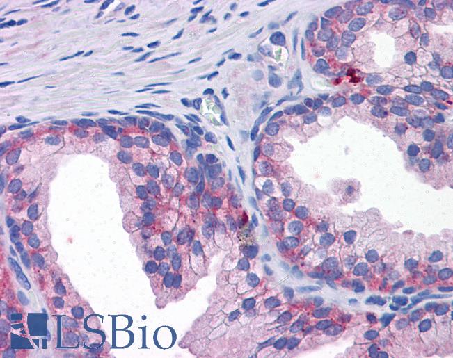 Anti-SLC39A3 antibody IHC of human prostate. Immunohistochemistry of formalin-fixed, paraffin-embedded tissue after heat-induced antigen retrieval. Antibody LS-B5354 concentration 5 ug/ml.