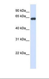 Transfected 293T cell lysate. Antibody concentration: 1.0 ug/ml. Gel concentration: 12%.