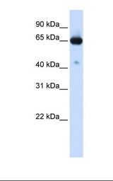 Transfected 293T cell lysate. Antibody concentration: 1.0 ug/ml. Gel concentration: 12%.