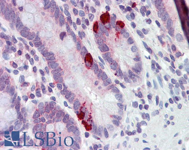 Anti-SLC39A5 antibody IHC of human small intestine. Immunohistochemistry of formalin-fixed, paraffin-embedded tissue after heat-induced antigen retrieval. Antibody LS-B3557 concentration 5 ug/ml.