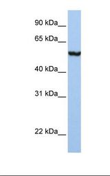 Placenta lysate. Antibody concentration: 1.0 ug/ml. Gel concentration: 12%.