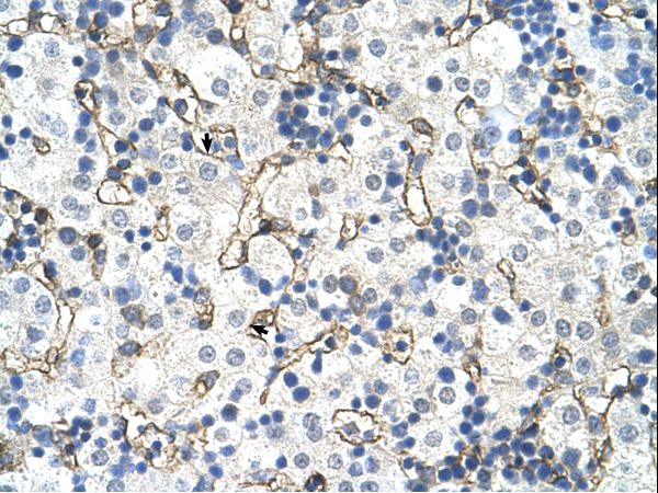 SLC39A5 antibody LS-C82473 was used in IHC to stain formalin-fixed, paraffin-embedded human liver.