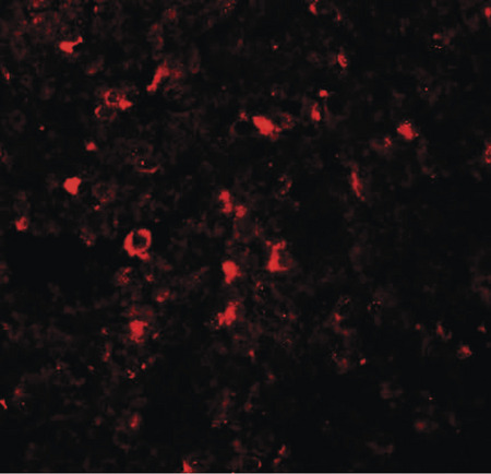 Immunofluorescence of ZIP5 in human spleen tissue with ZIP5 antibody at 20 ug/ml.