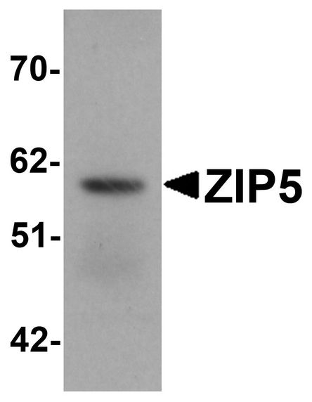 Western blot analysis of ZIP5 in human spleen tissue lysate with ZIP5 antibody at 1 ug/ml.