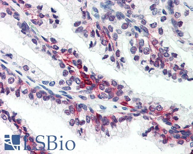 Anti-SLC39A6 antibody LS-A9835 IHC of human prostate. Immunohistochemistry of formalin-fixed, paraffin-embedded tissue after heat-induced antigen retrieval.