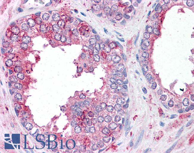 Anti-SLC39A6 antibody LS-A9287 IHC of human prostate. Immunohistochemistry of formalin-fixed, paraffin-embedded tissue after heat-induced antigen retrieval.