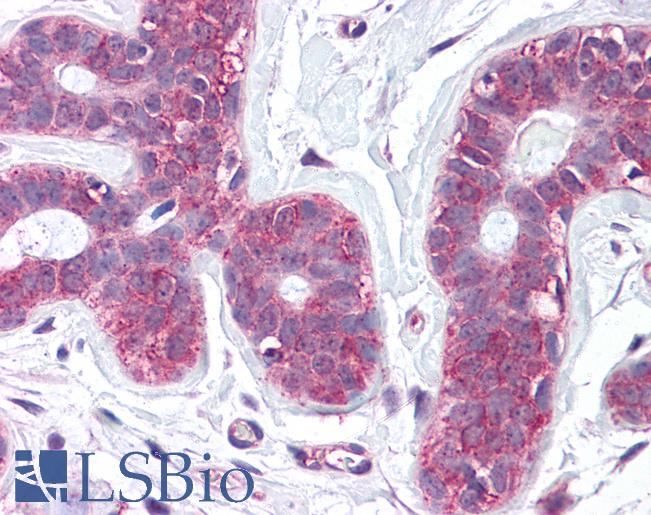 Anti-SLC39A6 antibody LS-A9287 IHC of human breast. Immunohistochemistry of formalin-fixed, paraffin-embedded tissue after heat-induced antigen retrieval.