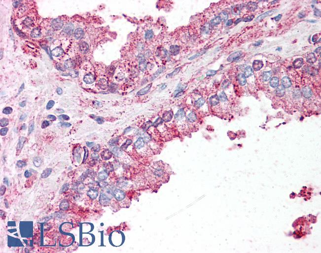 Anti-SLC39A6 antibody LS-A9283 IHC of human prostate. Immunohistochemistry of formalin-fixed, paraffin-embedded tissue after heat-induced antigen retrieval.