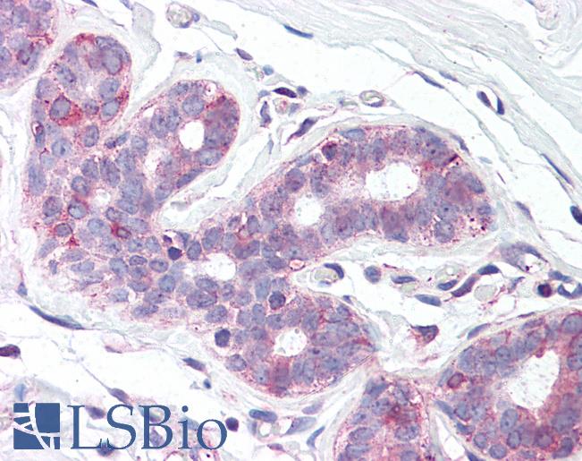 Anti-SLC39A6 antibody LS-A9283 IHC of human breast. Immunohistochemistry of formalin-fixed, paraffin-embedded tissue after heat-induced antigen retrieval.