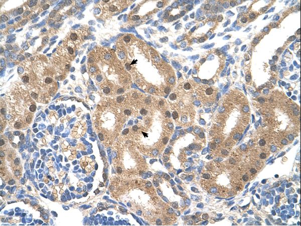 SLC39A6 antibody LS-C40431 was used in IHC to stain formalin-fixed, paraffin-embedded human kidney.