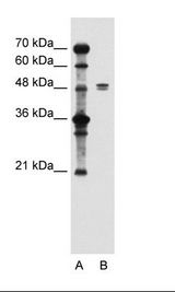 A: Marker, B: Jurkat Cell Lysate