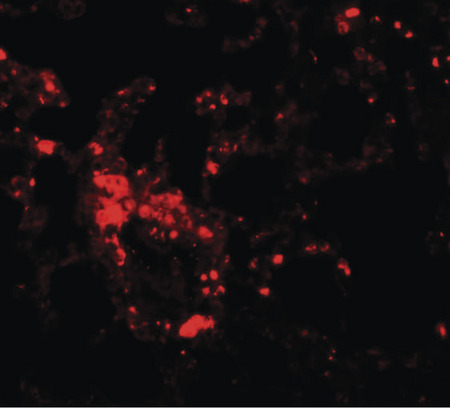 Immunofluorescence of ZIP6 in mouse lung tissue with ZIP6 antibody at 20 ug/ml.