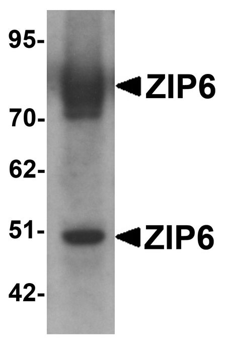 Western blot analysis of ZIP6 in mouse lung tissue lysate with ZIP6 antibody at 1 ug/ml.