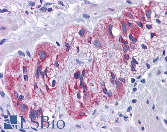 Anti-SLC39A7 antibody IHC of human colon, myenteric plexus. Immunohistochemistry of formalin-fixed, paraffin-embedded tissue after heat-induced antigen retrieval. Antibody LS-B5356 concentration 5 ug/ml.