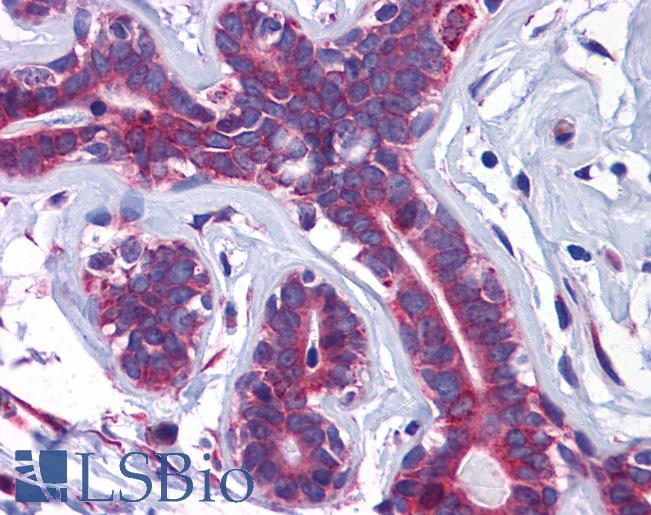 Anti-SLC39A7 antibody IHC of human breast. Immunohistochemistry of formalin-fixed, paraffin-embedded tissue after heat-induced antigen retrieval. Antibody LS-B5356 concentration 5 ug/ml.