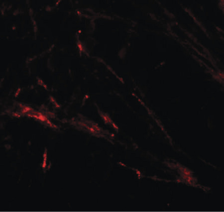 Immunofluorescence of ZIP7 in human brain tissue with ZIP7 antibody at 20 ug/ml.