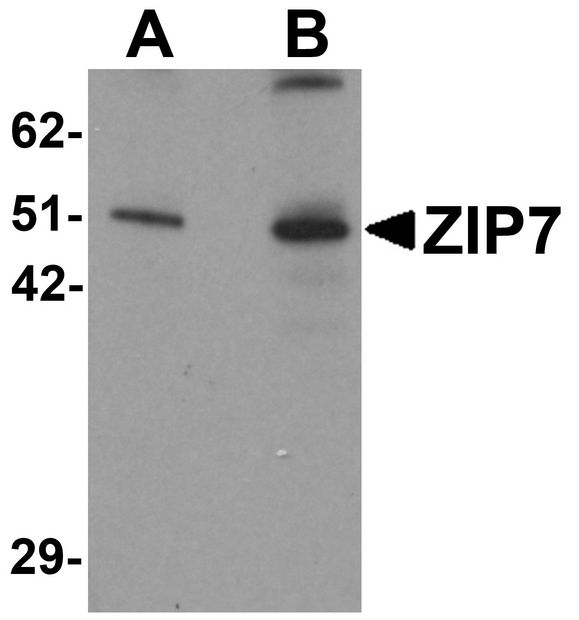 Western blot analysis of ZIP7 in mouse brain tissue lysate with ZIP7 antibody at (A) 0.5 and (B) 1 ug/ml.