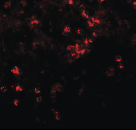 Immunofluorescence of ZIP8 in human spleen tissue with ZIP8 antibody at 20 ug/ml.