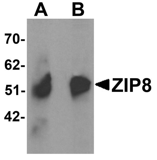 Western blot analysis of ZIP8 in human spleen tissue lysate with ZIP8 antibody at (A) 1 and (B) 2 ug/ml.