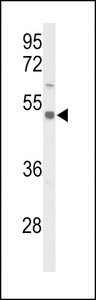 Western blot of S39A8 Antibody in CEM cell line lysates (35 ug/lane). S39A8 (arrow) was detected using the purified antibody.
